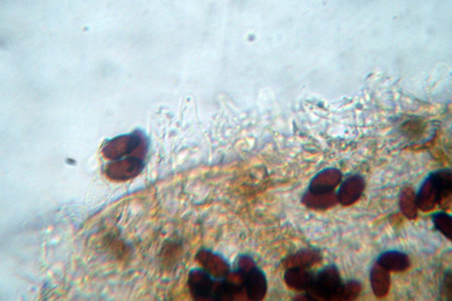 Due tentativi (miseri) di microscopia